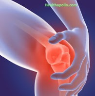 गठिया आर्थराइटिस Arthritis