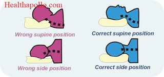 Correct sleeping posture for cervical
