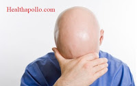 Don't take stress to prevent hair loss